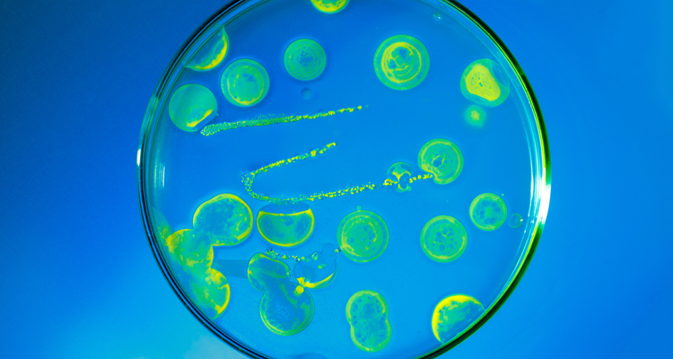 Science Fair Experiment: Grow Bacteria